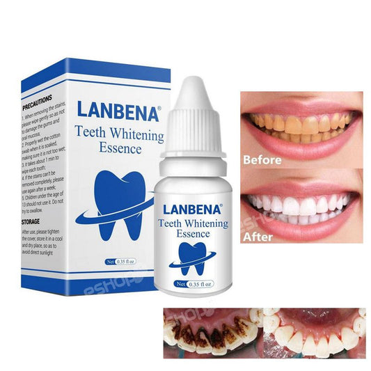 Instant teeth whitening -(0593602279) Delivery before payment within Accra and Kumasi.